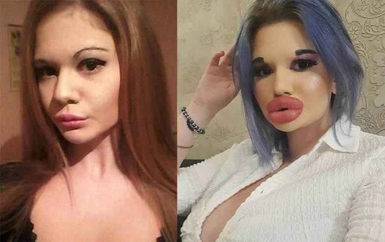 Andrea Ivanova Before and After