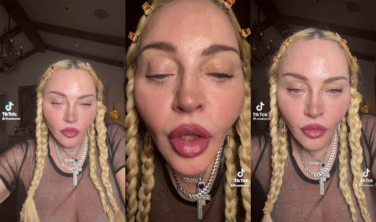What Happened To Madonna’s Face as Fans left shocked at her latest