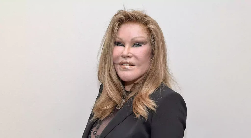 Rare PreSurgery Photos of 'Catwoman' Jocelyn Wildenstein Trend After